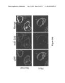 Compositions and Methods of Using Micro RNAs diagram and image