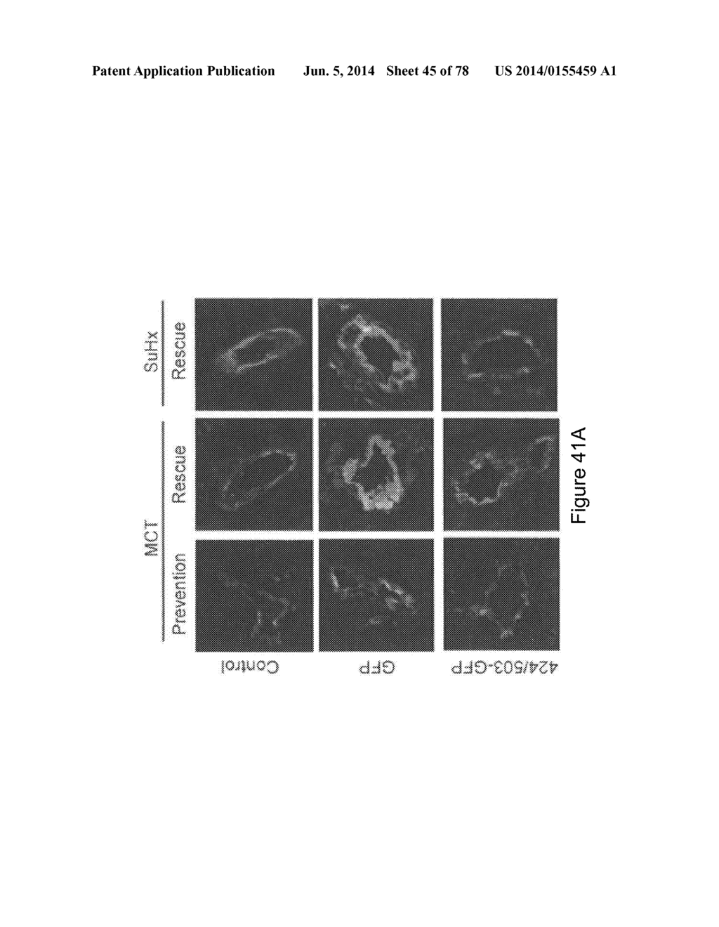 Compositions and Methods of Using Micro RNAs - diagram, schematic, and image 46