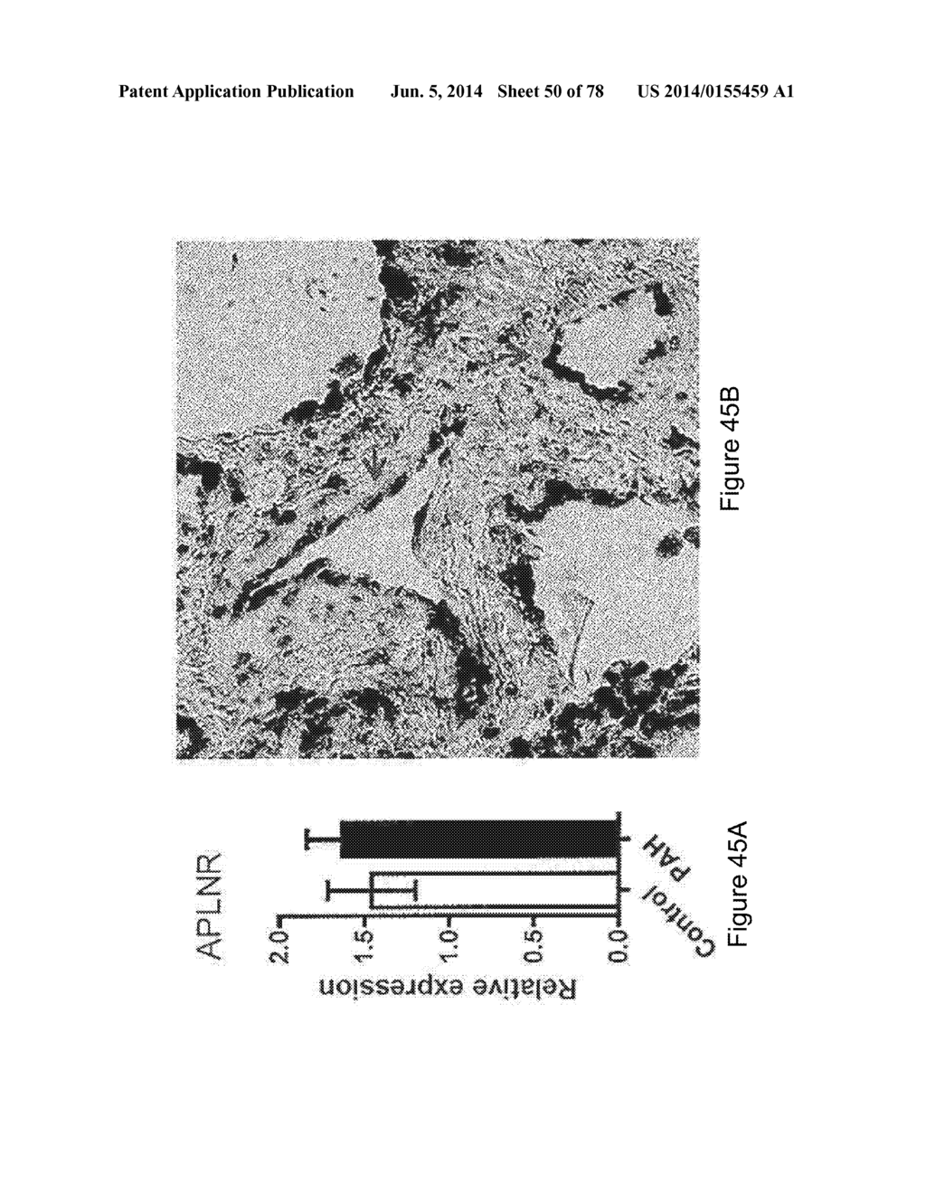 Compositions and Methods of Using Micro RNAs - diagram, schematic, and image 51