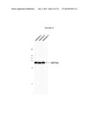 MODIFIED GLUCOSIDASE, BETA, ACID POLYNUCLEOTIDES FOR TREATING PROTEIN     DEFICIENCY diagram and image