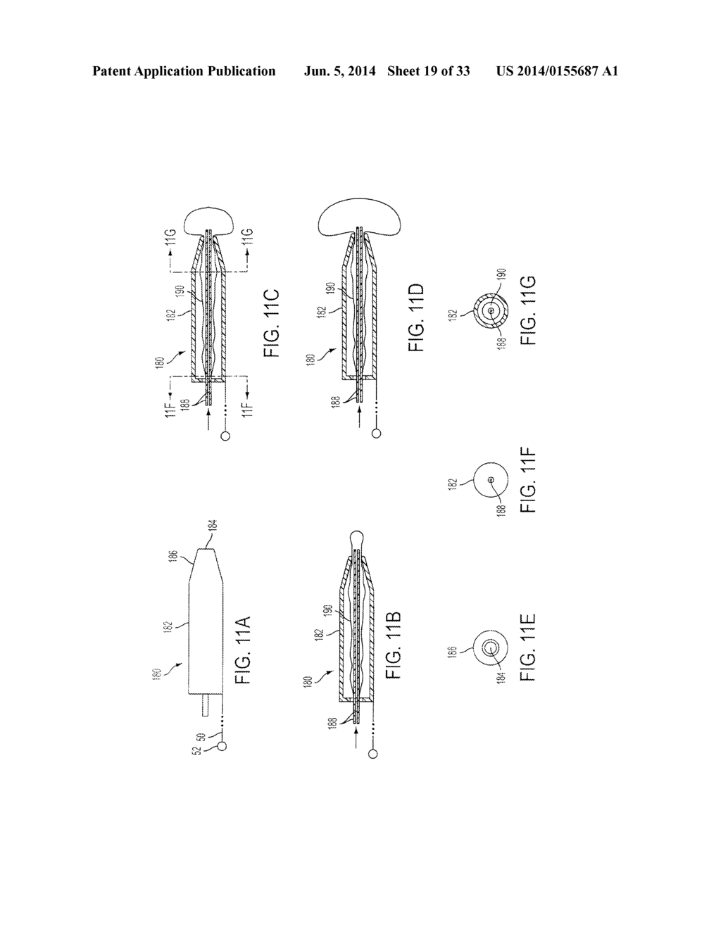 ATRAUMATIC MEDICAL DEVICE ANCHORING AND DELIVERY SYSTEM WITH ENHANCED     ANCHORING - diagram, schematic, and image 20