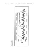 Methods And Systems For Respiratory Monitoring With Photoplethysmography diagram and image