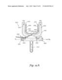 Methods And Systems For Respiratory Monitoring With Photoplethysmography diagram and image