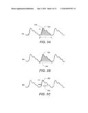 METHODS AND SYSTEMS THAT MONITOR FOR AN IMPENDING MYOCARDIAL INFARCTION diagram and image