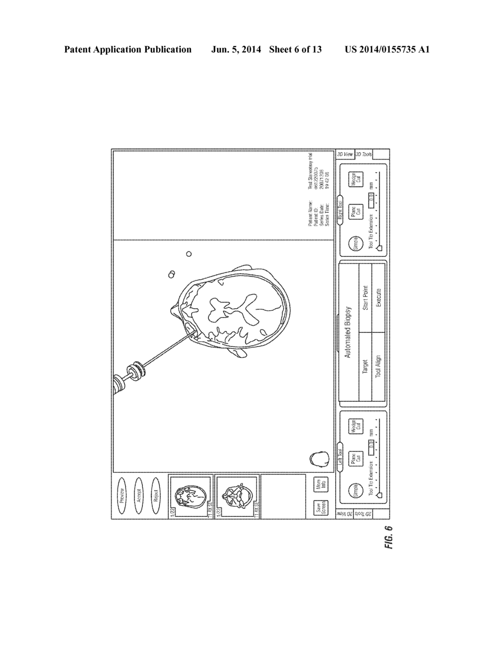 Methods, Devices, And Systems Useful In Registration - diagram, schematic, and image 07