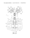 THORACIC LUMBAR SACRAL ORTHOSIS diagram and image