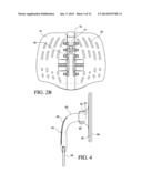 THORACIC LUMBAR SACRAL ORTHOSIS diagram and image