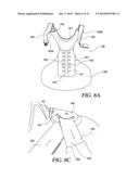 THORACIC LUMBAR SACRAL ORTHOSIS diagram and image