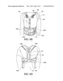 THORACIC LUMBAR SACRAL ORTHOSIS diagram and image