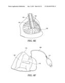 THORACIC LUMBAR SACRAL ORTHOSIS diagram and image