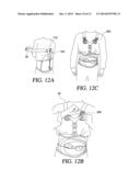 THORACIC LUMBAR SACRAL ORTHOSIS diagram and image