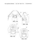 THORACIC LUMBAR SACRAL ORTHOSIS diagram and image