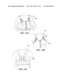 THORACIC LUMBAR SACRAL ORTHOSIS diagram and image