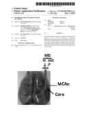 METHOD FOR TREATING BRAIN INJURY OR STROKE diagram and image