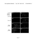 METHOD FOR TREATING BRAIN INJURY OR STROKE diagram and image