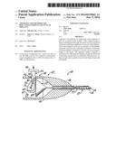 APPARATUS AND METHODS FOR IMPLANTING PARTICULATE OCULAR IMPLANTS diagram and image