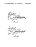 APPARATUS AND METHODS FOR IMPLANTING PARTICULATE OCULAR IMPLANTS diagram and image