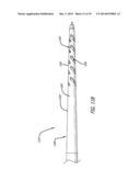 DEVICES AND METHODS FOR PERFUSION THERAPY diagram and image