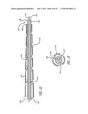 DEVICES AND METHODS FOR PERFUSION THERAPY diagram and image