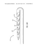 DEVICES AND METHODS FOR PERFUSION THERAPY diagram and image