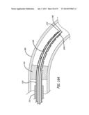 DEVICES AND METHODS FOR PERFUSION THERAPY diagram and image