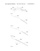 AFTER-TREATMENT OF REFRACTION CORRECTION BY OPHTHALMIC SURGERY diagram and image