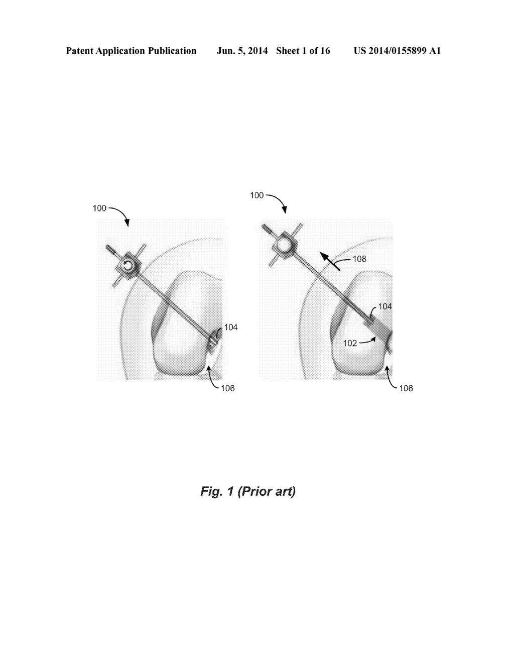 SURGICAL INSTRUMENT - diagram, schematic, and image 02