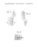 AUTOMATICALLY ADJUSTING PATELLA CUTTING GUIDE diagram and image