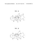 AUTOMATICALLY ADJUSTING PATELLA CUTTING GUIDE diagram and image