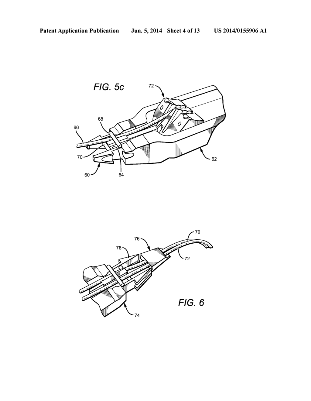 SURGICAL CABLE TENSIONING SYSTEM - diagram, schematic, and image 05