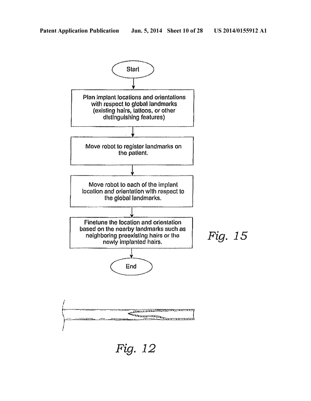 Automated System and Method for Harvesting or Implanting Follicular Units - diagram, schematic, and image 11