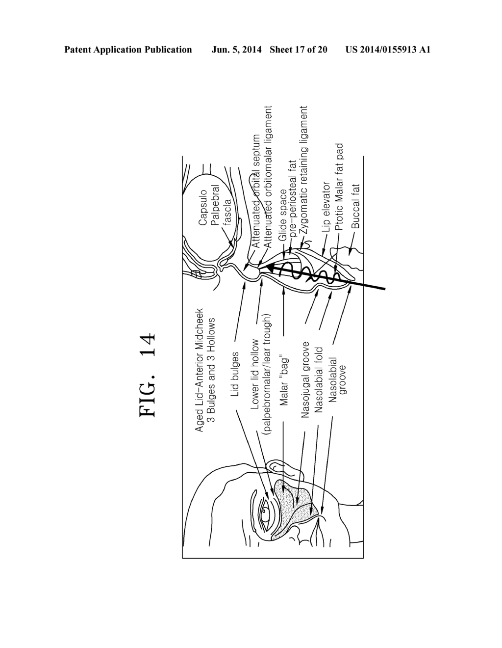 METHOD OF IMPROVING ELASTICITY OF TISSUE OF LIVING BODY - diagram, schematic, and image 18