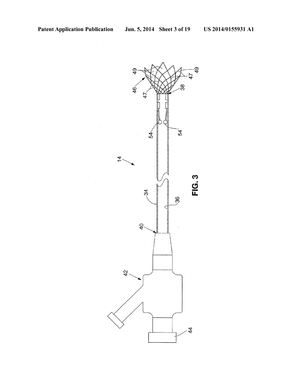 SYSTEM AND METHOD FOR TREATING ISCHEMIC STROKE - diagram, schematic, and image 04