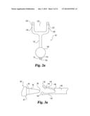 INSTRUMENTS AND METHODS FOR STABILIZATION OF BONY STRUCTURES diagram and image
