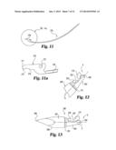 INSTRUMENTS AND METHODS FOR STABILIZATION OF BONY STRUCTURES diagram and image