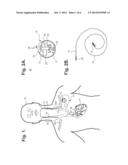 IMPLANTABLE NEUROSTIMULATOR-IMPLEMENTED METHOD FOR MANAGING BRADYCARDIA     THROUGH VAGUS NERVE STIMULATION diagram and image