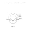 CARDIAC RHYTHM MANAGEMENT SYSTEM WITH INTRAMURAL MYOCARDIAL PACING LEADS     AND ELECTRODES diagram and image