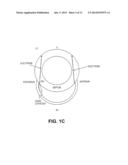 CARDIAC RHYTHM MANAGEMENT SYSTEM WITH INTRAMURAL MYOCARDIAL PACING LEADS     AND ELECTRODES diagram and image