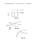 CARDIAC RHYTHM MANAGEMENT SYSTEM WITH INTRAMURAL MYOCARDIAL PACING LEADS     AND ELECTRODES diagram and image