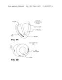 CARDIAC RHYTHM MANAGEMENT SYSTEM WITH INTRAMURAL MYOCARDIAL PACING LEADS     AND ELECTRODES diagram and image