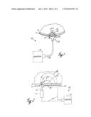 METHOD OF DESTROYING TISSUE CELLS BY ELECTROPORATION diagram and image