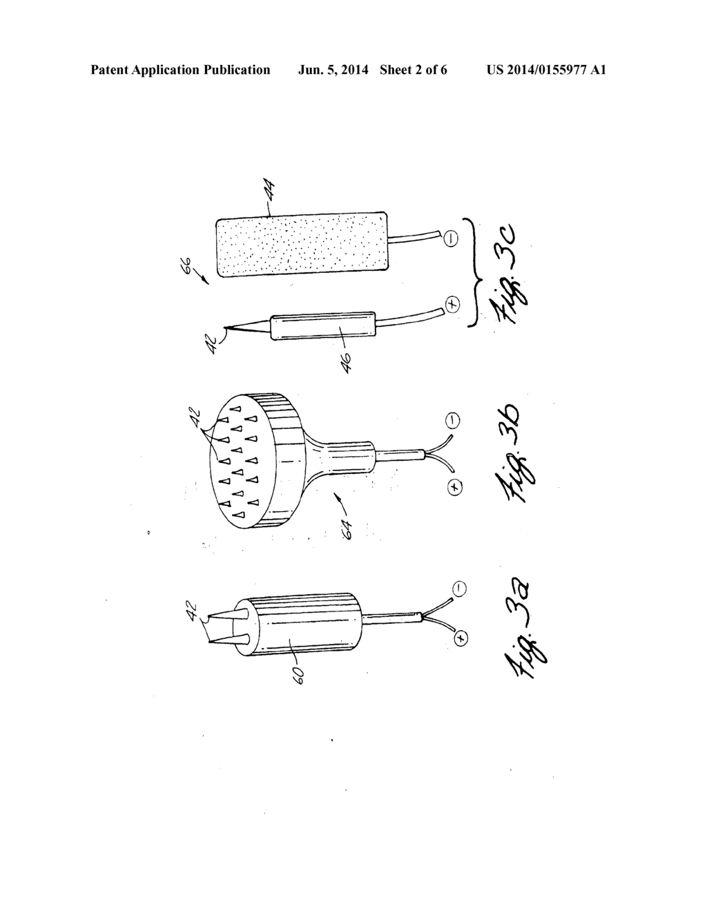 METHOD OF DESTROYING TISSUE CELLS BY ELECTROPORATION - diagram, schematic, and image 03