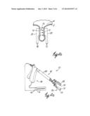 METHOD OF DESTROYING TISSUE CELLS BY ELECTROPORATION diagram and image