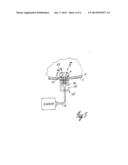 METHOD OF DESTROYING TISSUE CELLS BY ELECTROPORATION diagram and image