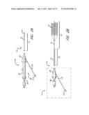 EXPANDABLE TIP ASSEMBLY FOR THROMBUS MANAGEMENT diagram and image