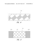 EXPANDABLE TIP ASSEMBLY FOR THROMBUS MANAGEMENT diagram and image