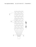 EXPANDABLE TIP ASSEMBLY FOR THROMBUS MANAGEMENT diagram and image