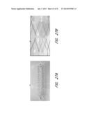 EXPANDABLE TIP ASSEMBLY FOR THROMBUS MANAGEMENT diagram and image