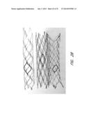 EXPANDABLE TIP ASSEMBLY FOR THROMBUS MANAGEMENT diagram and image