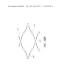 EXPANDABLE TIP ASSEMBLY FOR THROMBUS MANAGEMENT diagram and image